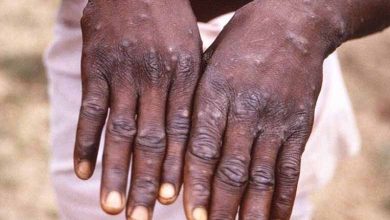 https://en.imarabic.com/the-health-ministry-in-turkey-coronavirus-cases-increased-to-more-than-300000/