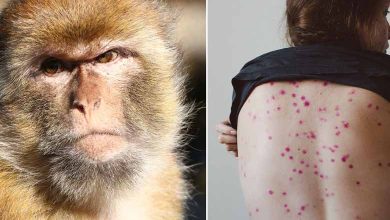 Monkeypox: is there a risk of transmission to pets?