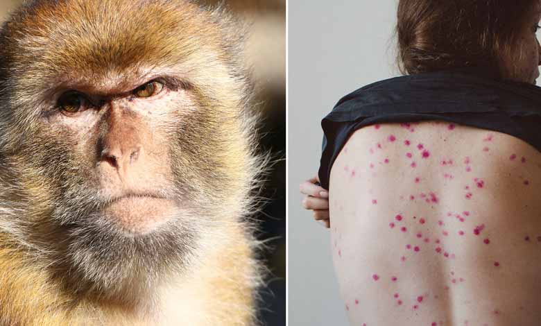 Monkeypox: is there a risk of transmission to pets?