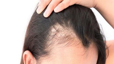 Scientific breakthrough could end hair loss problem