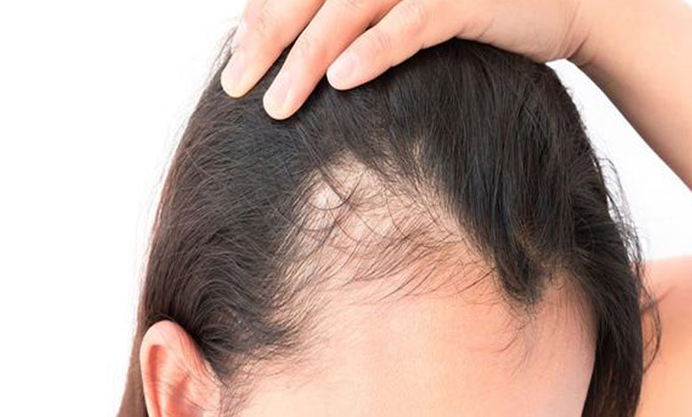 Scientific breakthrough could end hair loss problem