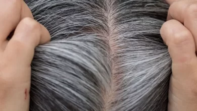 The Impact of Diet and Lifestyle on Premature Graying: How Sugar Processed Foods and Smoking Can Affect Hair Pigmentation