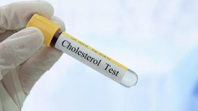 The worst foods that increase cholesterol
