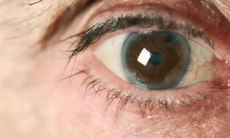 Understanding Eye Diseases- Types, Symptoms and Prevention