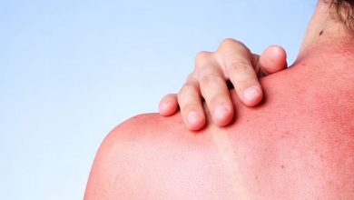 How long does a sun allergy last?