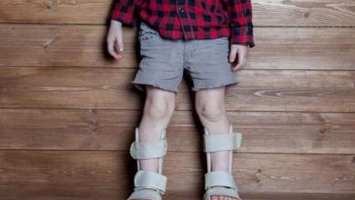Osteomalacia : causes, symptoms and treatments 