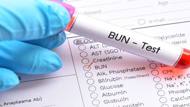 Urea: What is the normal level and how do I read a blood test?
