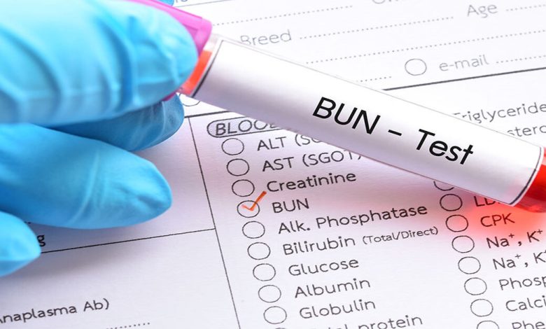 Urea: What is the normal level and how do I read a blood test?