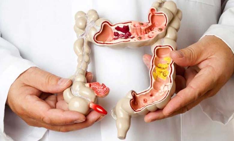 Affordable Medication: Good news for irritable bowel syndrome patients 