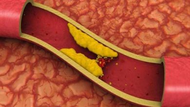 Arterial stiffness in young people: A study reveals causes and risks