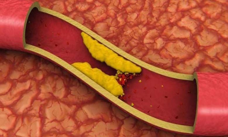 Arterial stiffness in young people: A study reveals causes and risks