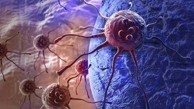 New innovative method destroys 99% of cancer cells