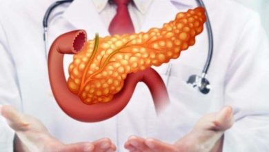 Identifying the protein associated with Pancreatic Cancer