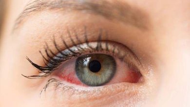 The Eye: The Most Affected Organ by Rising Temperatures