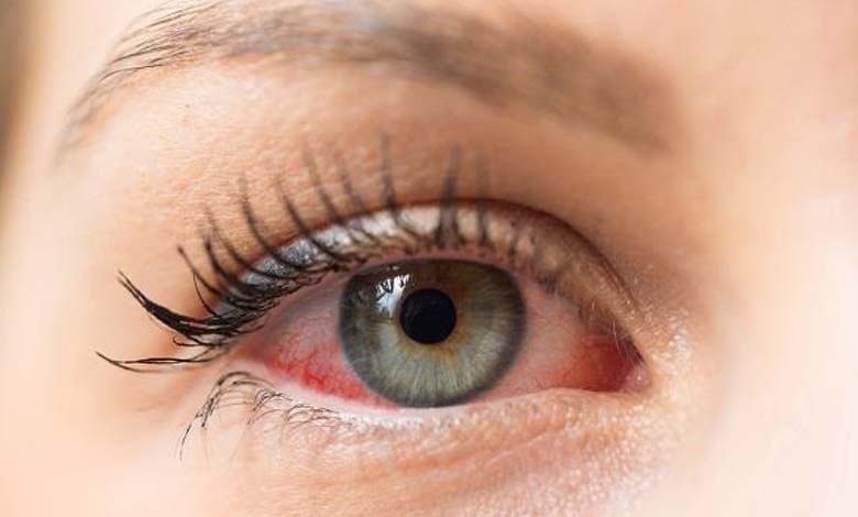 The Eye: The Most Affected Organ by Rising Temperatures