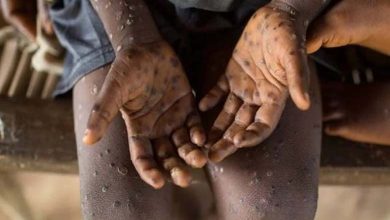 Nigeria announces an increase in "monkeypox" cases to 48