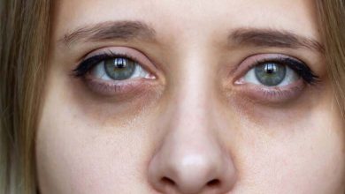 One Cause is Dehydration... Reasons Behind Dark Circles Around the Eyes