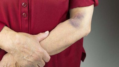 Causes of Bruising in Elderly People