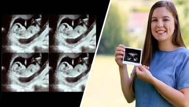 50 Million Views: A Rare Birth of Twins in Two Separate Uteruses