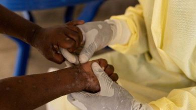 Zambia Reports Its First Case of Monkeypox