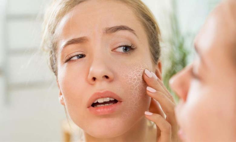 With Winter Approaching… 5 Tips for Treating Dry Skin