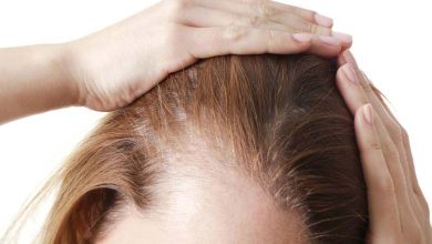 Surprising Discovery for Treating Hair Loss and Genetic Baldness