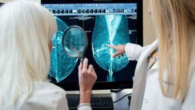 Artificial Intelligence Excels in Detecting Breast Cancer