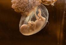 First Medical Trial: A Fetus Receives a Life-Saving Drug in the Womb