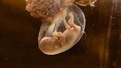 First Medical Trial: A Fetus Receives a Life-Saving Drug in the Womb