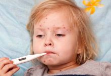 New Measles Outbreak Sparks Panic in Texas and New Mexico