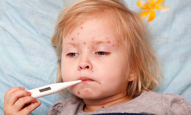 New Measles Outbreak Sparks Panic in Texas and New Mexico