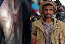 Tortured... Yemeni Poet Dies in a Muslim Brotherhood Prison in Marib