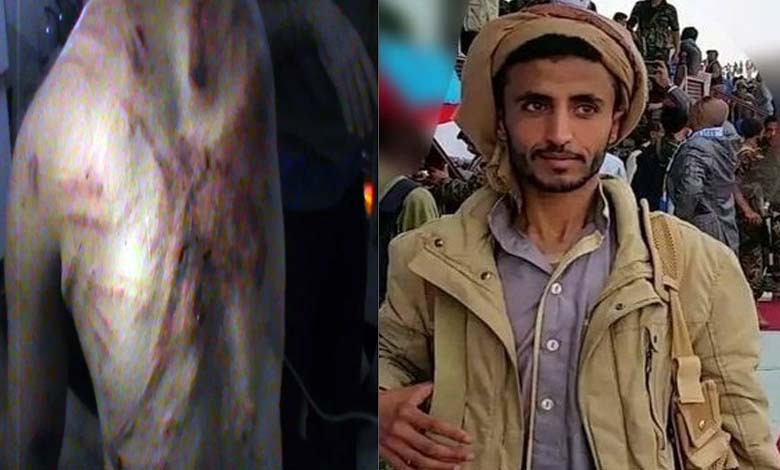 Tortured... Yemeni Poet Dies in a Muslim Brotherhood Prison in Marib