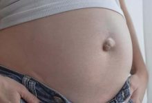 Why Does the Belly Button Change Shape During Pregnancy?