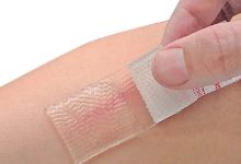 Is Silicone Tape Truly Effective for Scar Treatment?