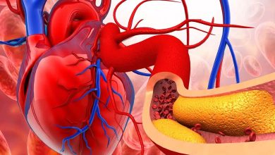 3 Symptoms That May Reveal Coronary Artery Blockage