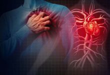What’s the difference between a heart attack and a panic attack?