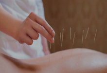 Acupuncture: Effective Treatment or Mere Illusion?