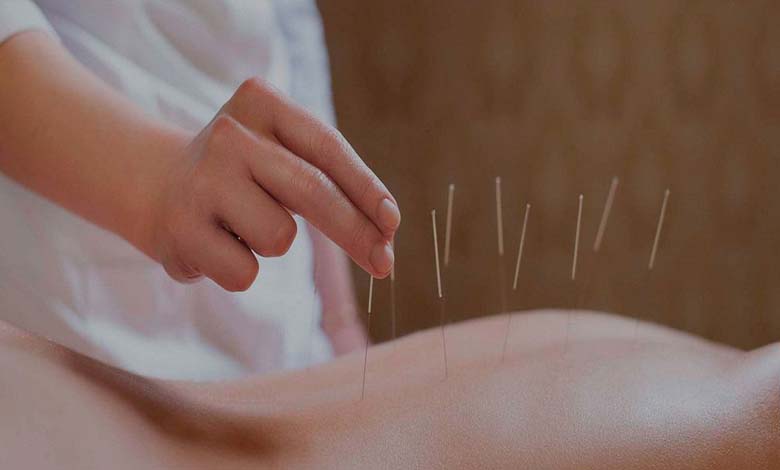 Acupuncture: Effective Treatment or Mere Illusion?