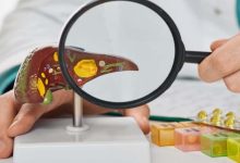 How to Prevent Recurring Gallbladder Inflammation (Cholecystitis)