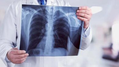 5 ways weather fluctuations affect lung health