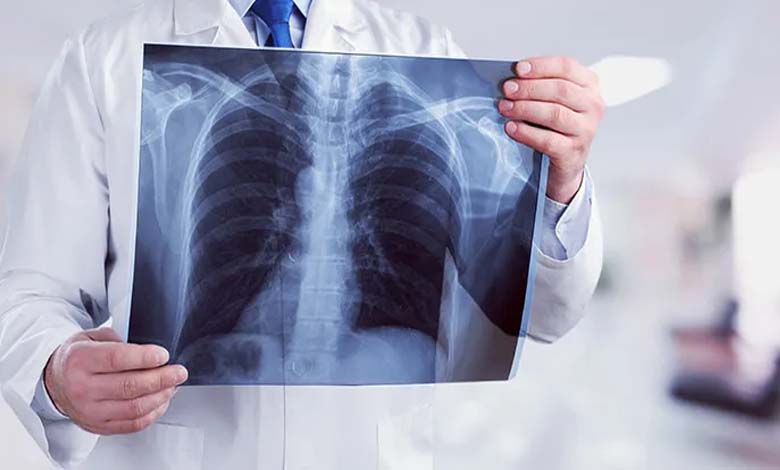 5 ways weather fluctuations affect lung health