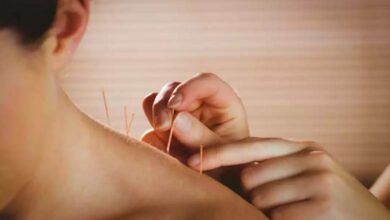 Acupuncture: Effective Results or Mere Hype?