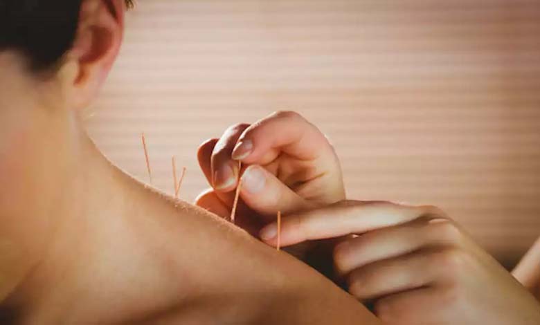 Acupuncture: Effective Results or Mere Hype?