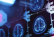 How brain cholesterol affects memory and learning