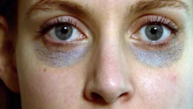 How vitamin deficiencies affect the formation of dark circles under the eyes