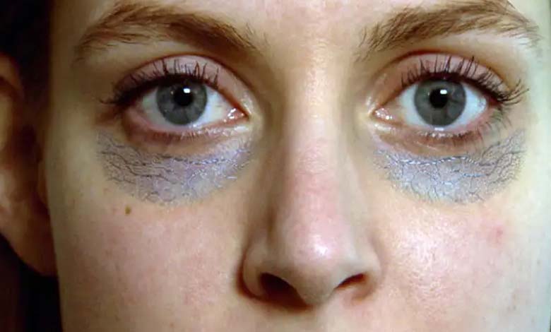 How vitamin deficiencies affect the formation of dark circles under the eyes
