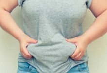 Abdominal Fat Increases Risk of Dementia After Menopause