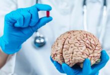 Early warning signs that may signal a stroke one month before it occurs