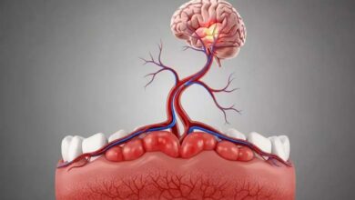 Gum Diseases: A Risk Factor for White Matter Damage in the Brain